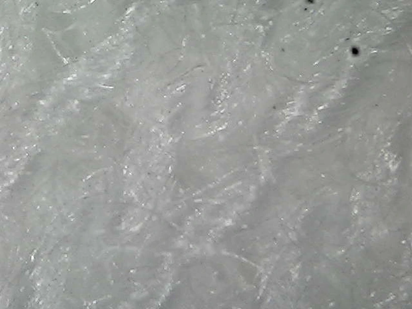 클리닝 후 현미경 사진