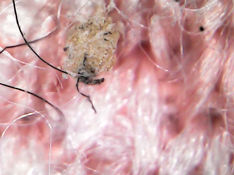 클리닝 전 현미경 사진